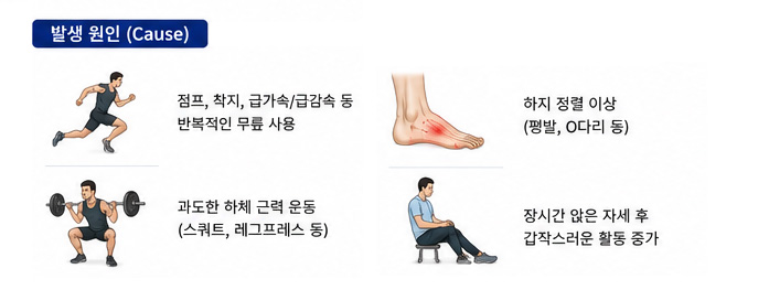 대퇴사두근건염 발생 원인 설명 이미지