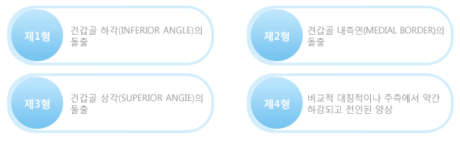 제1형,견갑골 하각(inferior angle)의 돌출. 제2형,견갑골 내측연(medial border)의돌출. 제3형, 견갑골 상각(superior angie)의돌출. 제4형, 비교적 대칭적이나 주측에서 약간하강되고 전인된 양상