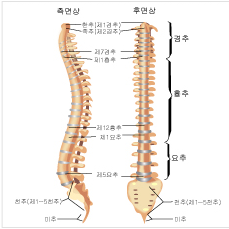 척추옆모습 사진