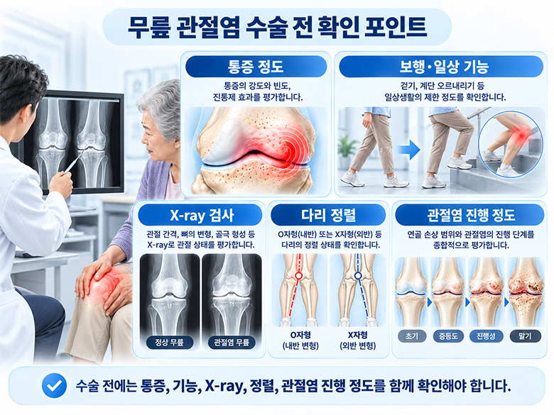 무릎 관절염 수술 전 확인하는 통증과 기능, 관절염 범위, 하지 정렬 검사 기준