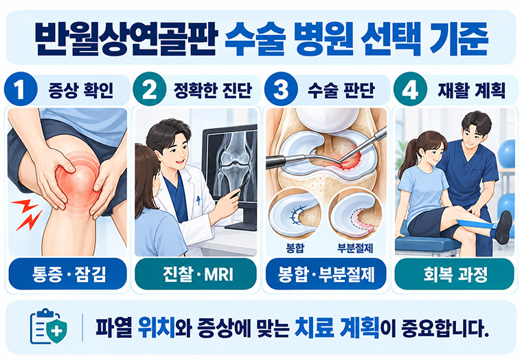 반월상연골판파열 수술 병원 선택 시 확인할 증상, 진단, 수술 판단과 재활 계획