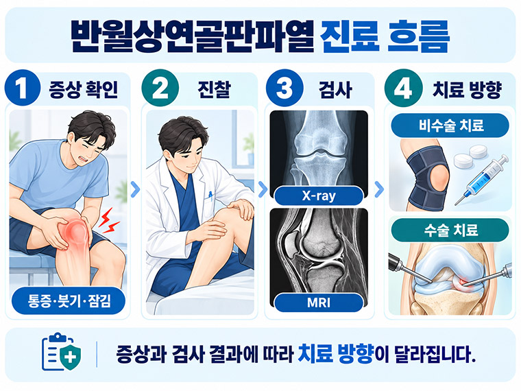반월상연골판파열의 증상 확인부터 진찰, X-ray와 MRI 검사, 비수술 및 수술 치료 결정 과정