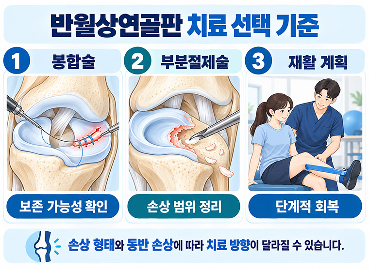 반월상연골판파열의 봉합술과 부분절제술 선택 및 수술 후 재활 계획