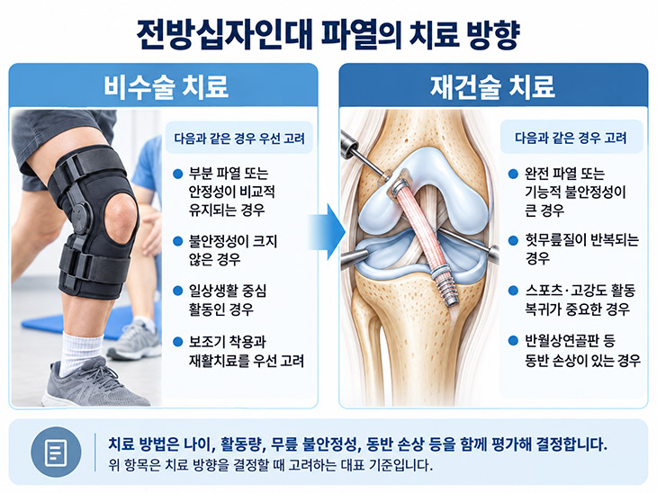 전방십자인대 파열의 비수술 치료와 재건술 치료 방향
