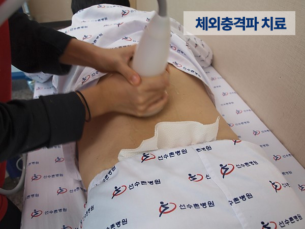 체외충격파 치료 모습