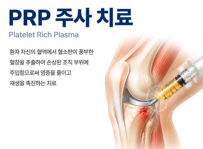 PRP 주사 치료 설명 이미지