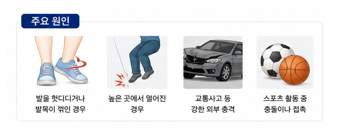 발목골절의 주요 원인 설명 이미지