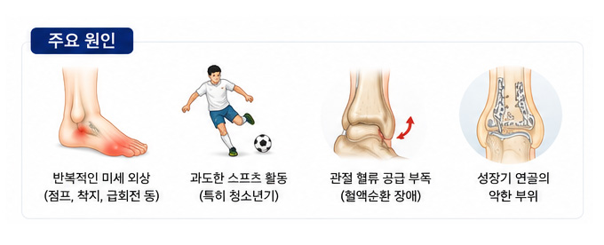 요족의 주요원인 설명 이미지